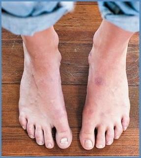 Grace Helbig feet photo thumbnail