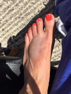 Katie Price feet photo thumbnail