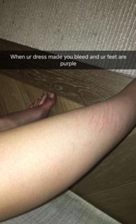 Kylie Jenner feet photo thumbnail
