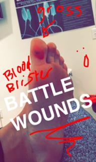 Demi Lovato feet photo thumbnail