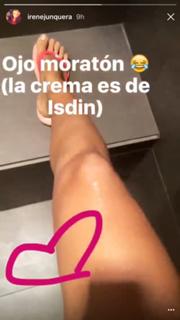 Irene Junquera feet photo thumbnail