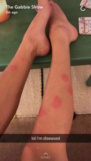Gabbie Hanna feet photo thumbnail