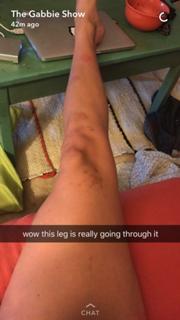 Gabbie Hanna feet photo thumbnail