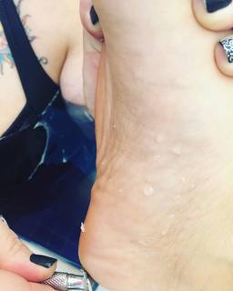 Karin Klemp feet photo thumbnail