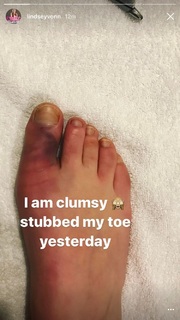 Lindsey Vonn feet photo thumbnail