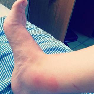 Yoseline Hoffman feet photo thumbnail