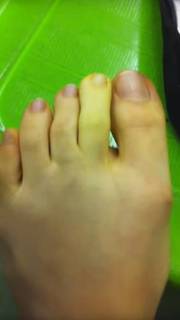 Yoseline Hoffman feet photo thumbnail