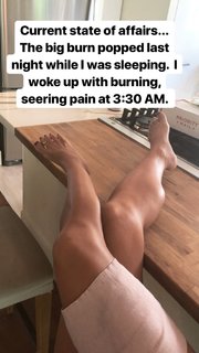 Kino MacGregor feet photo thumbnail