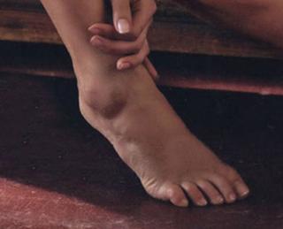 Petra Nemcova feet photo thumbnail