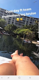 Vicky Pattison feet photo thumbnail