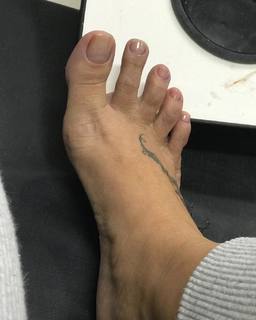 Karin Klemp feet photo thumbnail