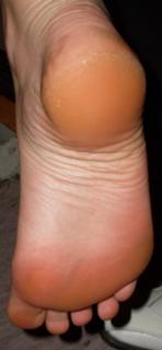 Joss Stone feet photo thumbnail