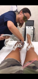 Federica Fontana feet photo thumbnail