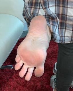 Kyle Unfug feet photo thumbnail