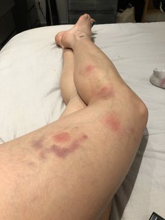 Yoseline Hoffman feet photo thumbnail