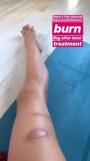 Kino MacGregor feet photo thumbnail
