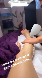 Katarzyna Cichopek feet photo thumbnail