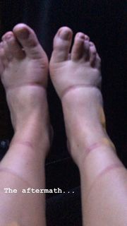 Lindsey Vonn feet photo thumbnail