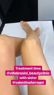 Chiara Ferragni feet photo thumbnail