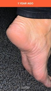 Kyle Unfug feet photo thumbnail
