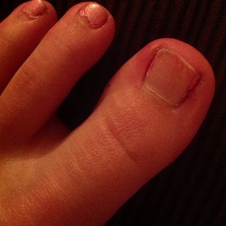 Colleen Ballinger feet photo thumbnail