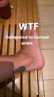 Rita Ora feet photo thumbnail