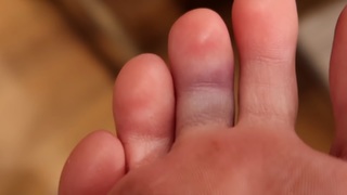 Colleen Ballinger feet photo thumbnail