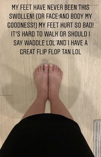 Nikki Garcia feet photo thumbnail