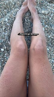 Mary Synatsaki feet photo thumbnail