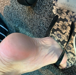 Kyle Unfug feet photo thumbnail