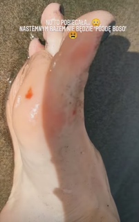 Karolina Pisarek feet photo thumbnail