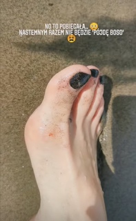 Karolina Pisarek feet photo thumbnail