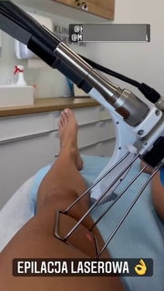 Karolina Kowalkiewicz feet photo thumbnail