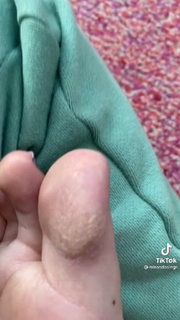 Colleen Ballinger feet photo thumbnail