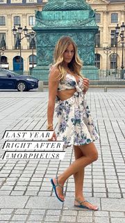 Kelly Bensimon feet photo thumbnail