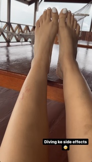Parineeti Chopra feet photo thumbnail