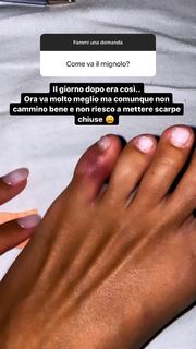 Giorgia Crivello feet photo thumbnail