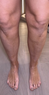 Vicky Pattison feet photo thumbnail