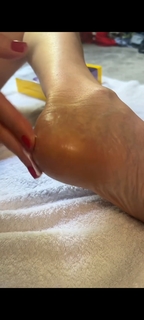 Lisa Snowdon feet photo thumbnail