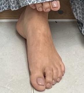 Millie Mackintosh feet photo thumbnail