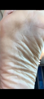Kyle Unfug feet photo thumbnail