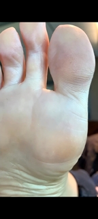 Kyle Unfug feet photo thumbnail