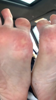 Kyle Unfug feet photo thumbnail