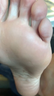Kyle Unfug feet photo thumbnail