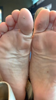 Kyle Unfug feet photo thumbnail