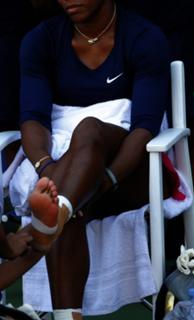 Serena Williams feet photo thumbnail