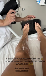 Karolina Kowalkiewicz feet photo thumbnail