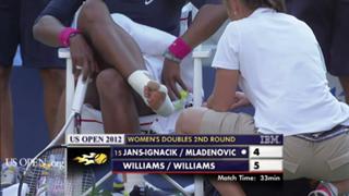 Serena Williams feet photo thumbnail