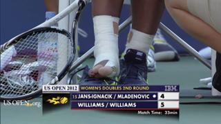 Serena Williams feet photo thumbnail