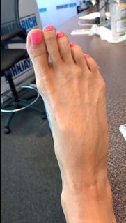 Kyle Unfug feet photo thumbnail